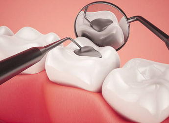 Implant dental