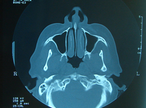 Radiografía digital panorámica para cirugía